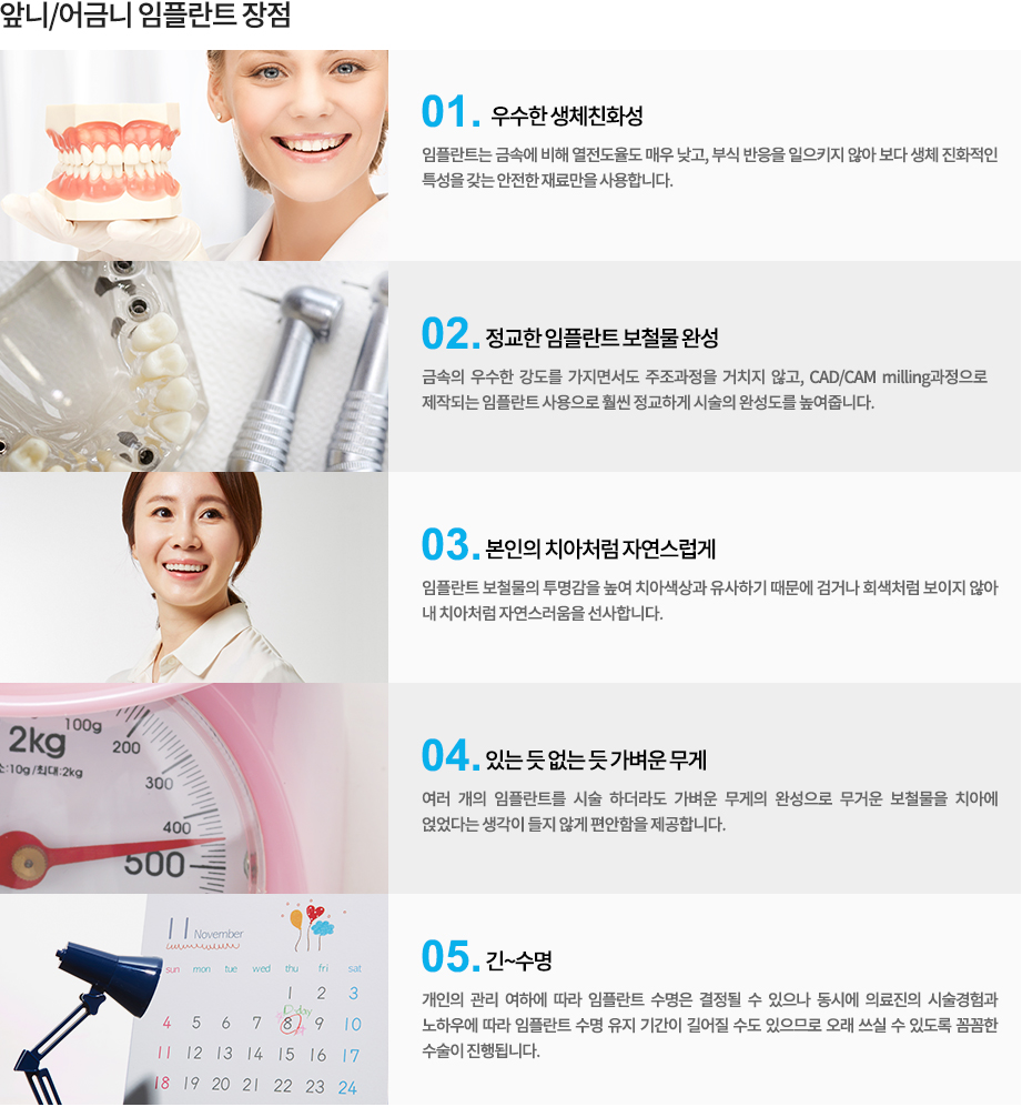 임플란트 보철물의 형태를 보여주는 치아 모형