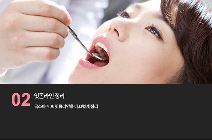 구강 검사 참고 사진