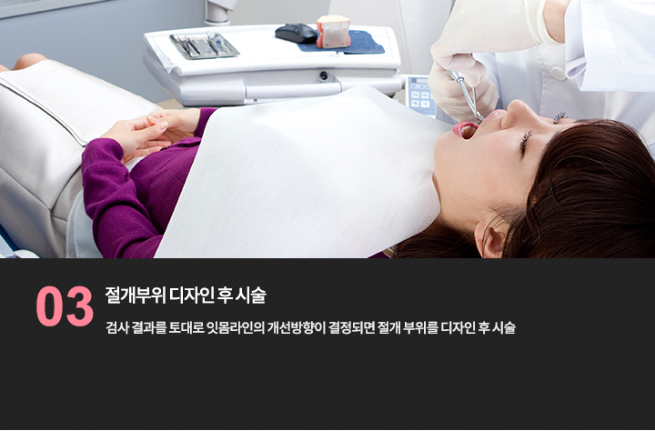 치과 시술 참고 사진