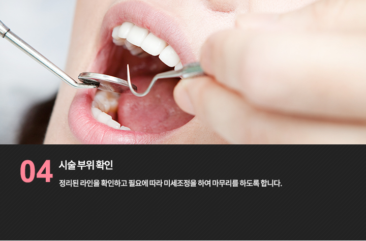 시술 부위 확인 참고 사진