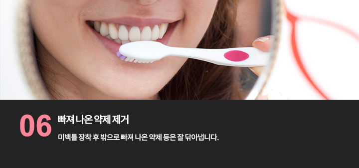 치아 표면 관리 참고 사진